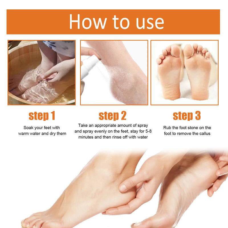 Calluses Remover Foot Spray Anti-Drying Exfoliating Heel Cracked Repair Pedicure Hand Elbow Eliminate Dead Skin Foot Liquid 30ml