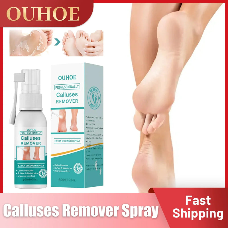 Calluses Remover Foot Spray Peeling Dead Skin Exfoliator Anti Drying Crack Heels Smoothing Soften Repair Whiten Foot Care Liquid
