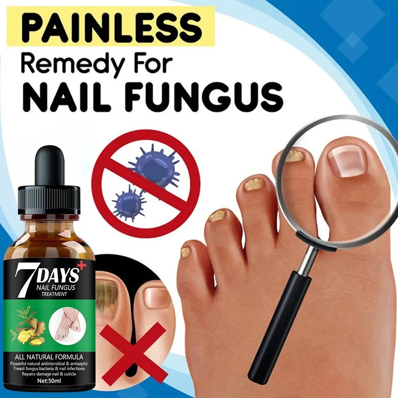 7DAYS Repair Nail Fungus Treatments Essence Foot Care Serum Toe Nails Fungal Removal Gel Anti-Infection Onychomycosis Care Tool