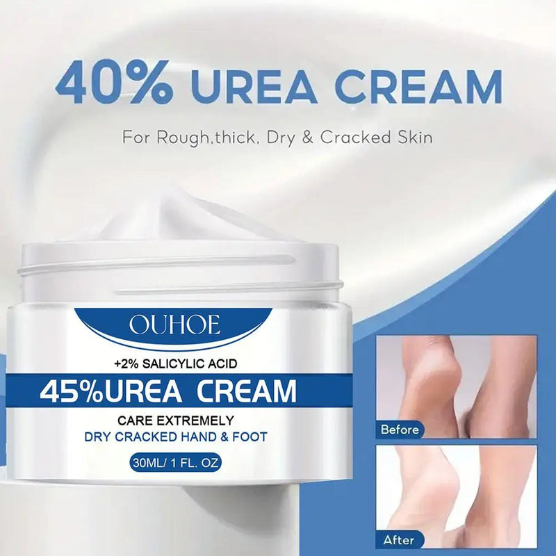 Anti Drying Foot Cream Urea Crack Heel Calluses Dead Hydration Chapping Repair Soothing Care Removal Feet Moisturizing Skin Q1b7