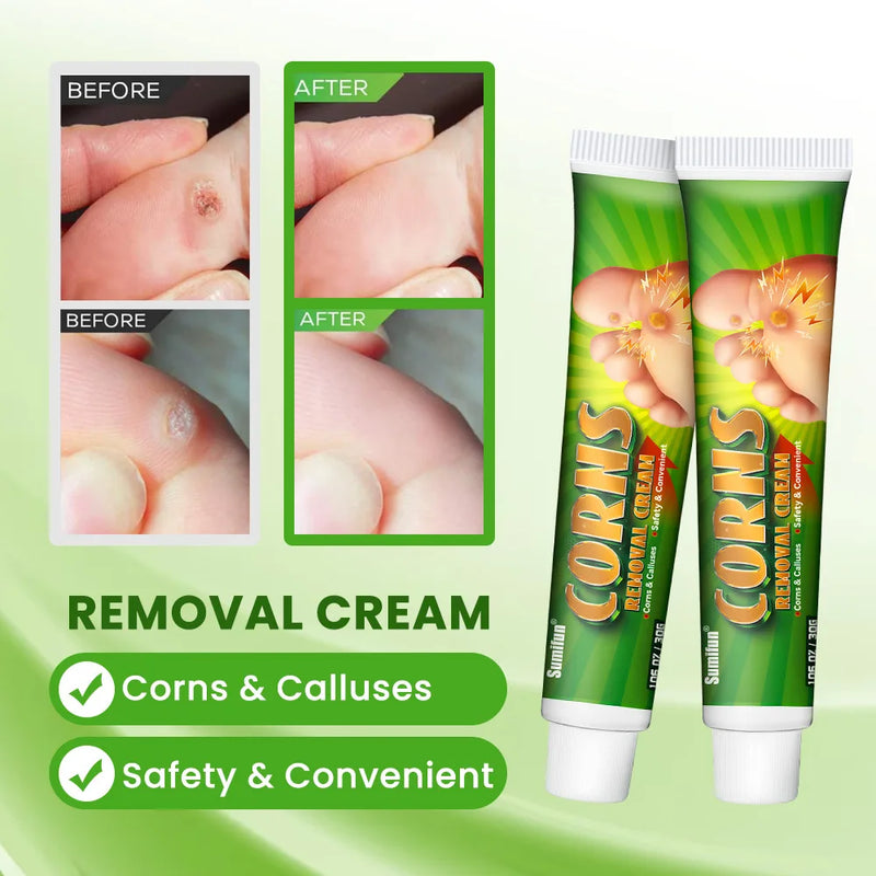 Foot Corn Remover Cream Chicken Eye Skin Infection Treatment Ointment Feet Dead Skin Calluses Removal Tool Health Care 내성발톱