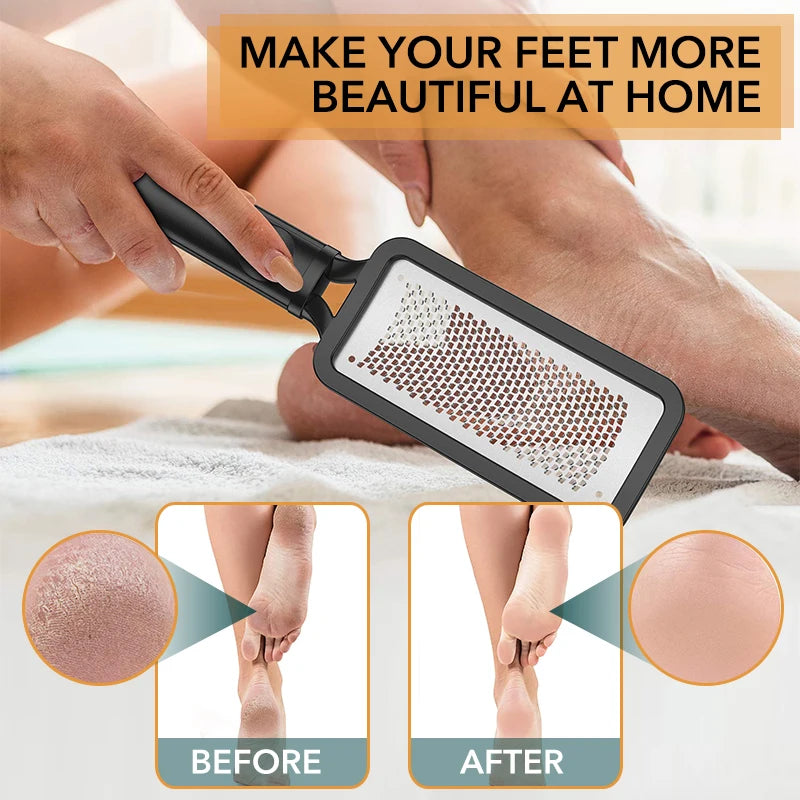 1Pcs Foot Rapr File For Women Man Heel Black Scrubber Dry Dead Skin Callus Remover Feet Skin Care Spa Products Pedicure Tools