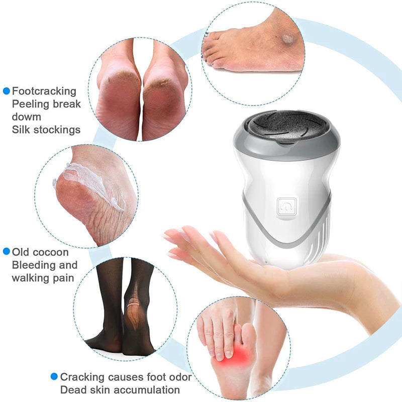 Wireless Electric Callus Remover Feet Care Grinder Pedicure Cuticle Trimmer Set Foot File Clean Tools For Hard Cracked Dead Skin